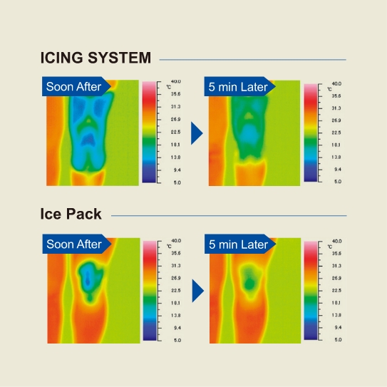 Difference in Effectiveness Between ICING SYSTEM and Ice Pack.