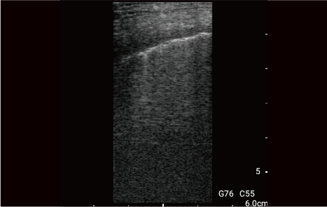 10 MHz Linear Transducer