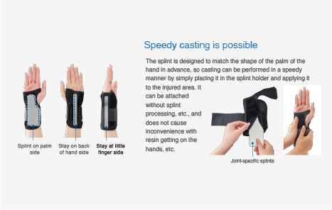 Hybrid Splint Wrist